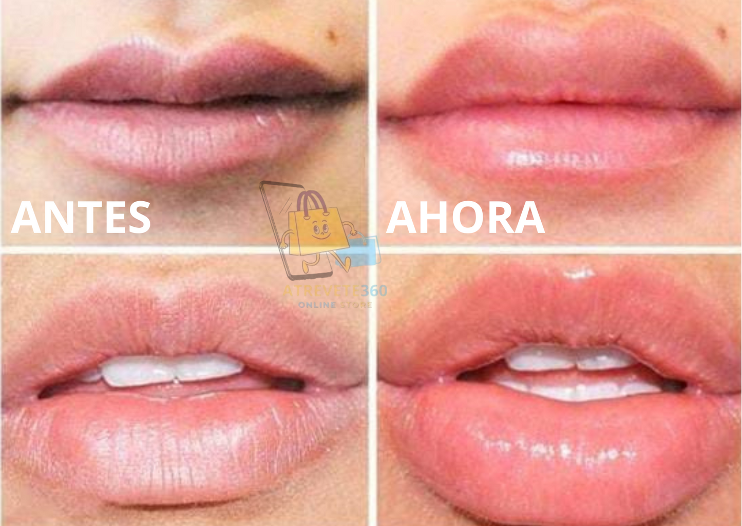 Gloss Voluminizador De Labios® Promo 3x1